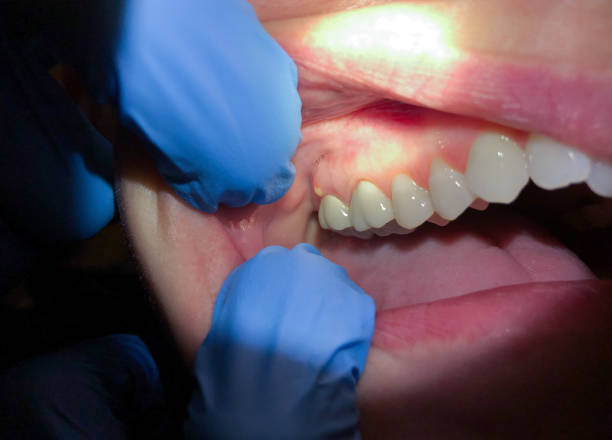 Best After-Hours Dental Trauma Care in Pine Knot, KY